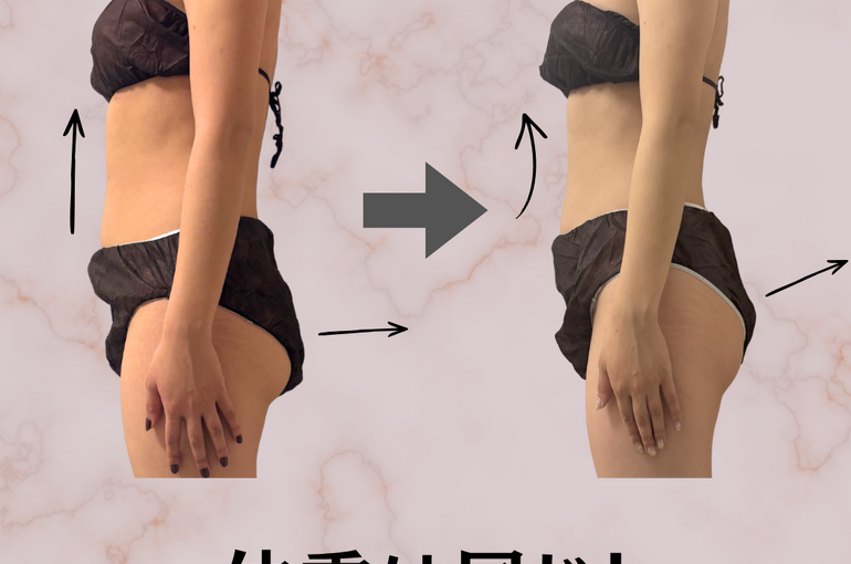 before→after - 10