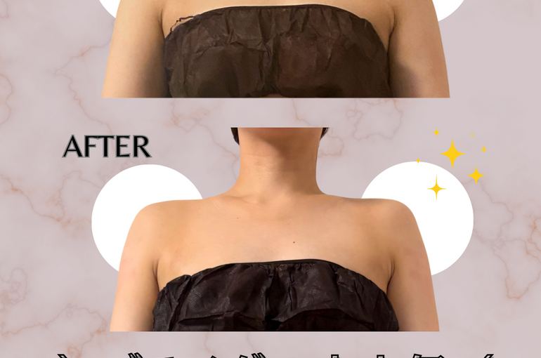 before→after - 11