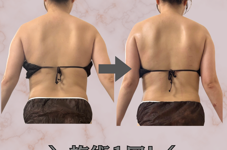 before→after - 15