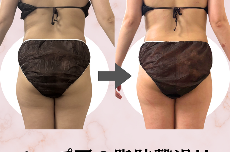before→after - 14