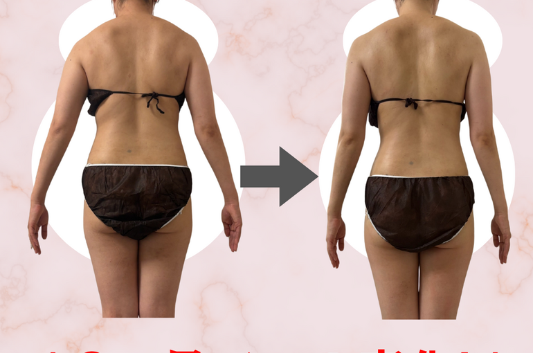 before→after - 17