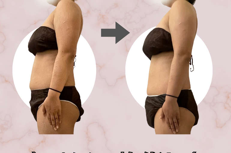 before→after - 21
