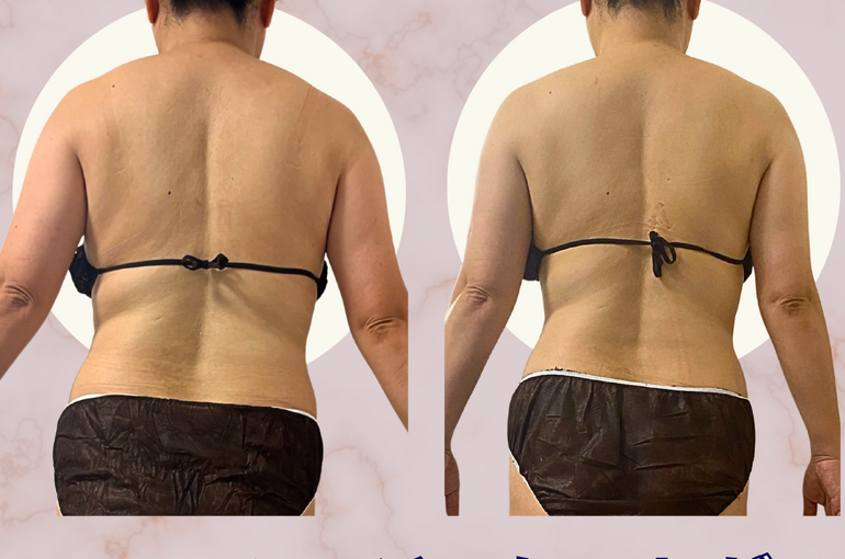 before→after - 32