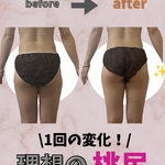 before→after