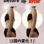before→after - 32