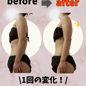 before→after - 32