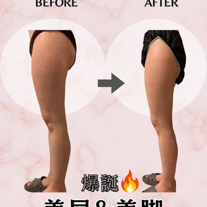 before→after - 4