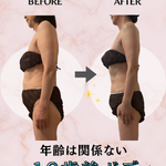 before→after - 5