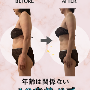 before→after - 5