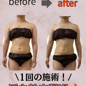 before→after