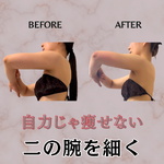 before→after