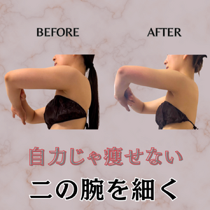 before→after