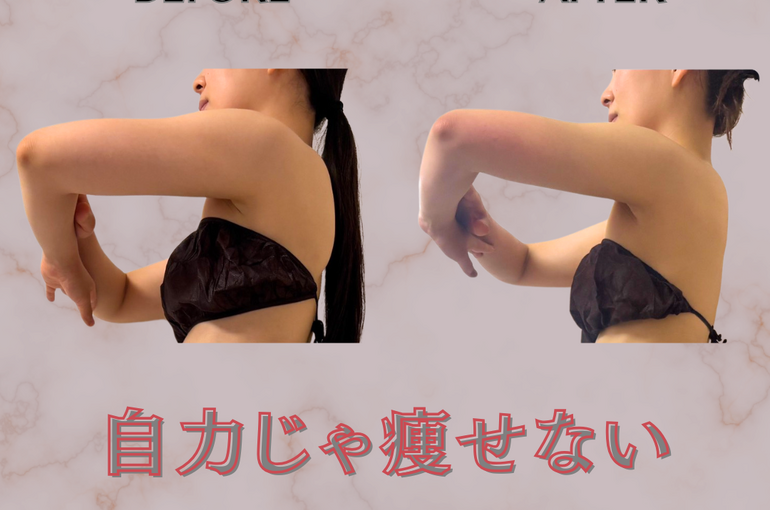 before→after