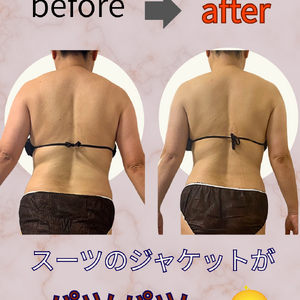 before→after